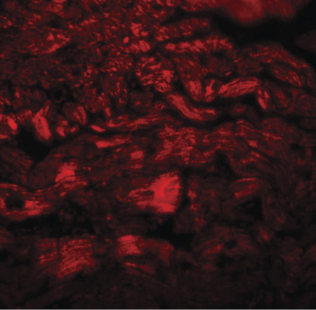 Immunofluorescence of PPAPDC3 in mouse heart tissue with PPAPDC3 antibody at 20 ug/ml.