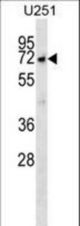 MKKS Antibody western blot of U251 cell line lysates (35 ug/lane). The MKKS antibody detected the MKKS protein (arrow).