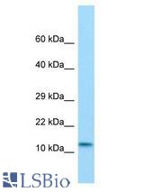 MKL2 antibody Western Blot of Rat Pancreas. Antibody dilution: 1 ug/ml.