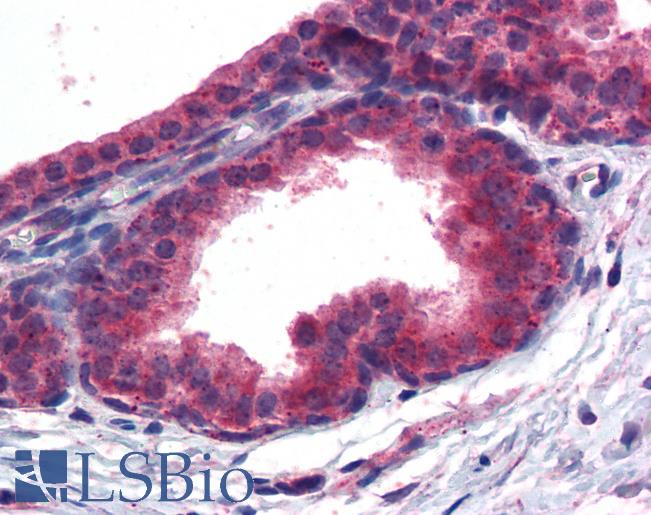 Anti-PPAR Delta antibody IHC of human prostate. Immunohistochemistry of formalin-fixed, paraffin-embedded tissue after heat-induced antigen retrieval. Antibody LS-B3934 concentration 3.75 ug/ml.