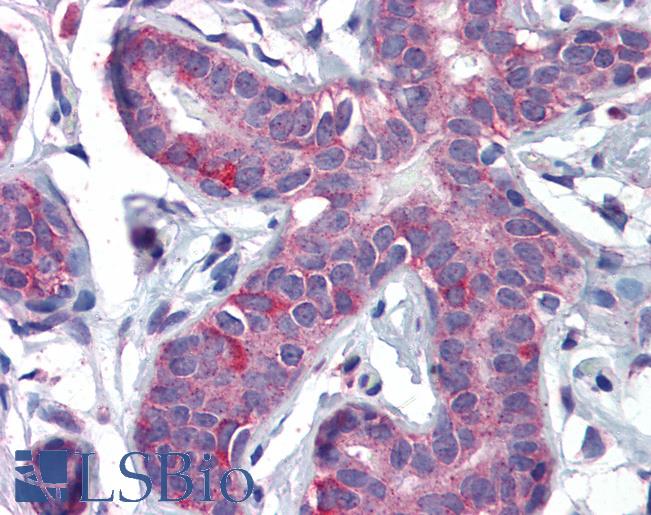 Anti-PPAR Delta antibody IHC of human breast. Immunohistochemistry of formalin-fixed, paraffin-embedded tissue after heat-induced antigen retrieval. Antibody LS-B3934 concentration 3.75 ug/ml.
