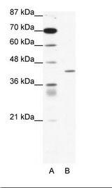 A: Marker, B: Jurkat Cell Lysate