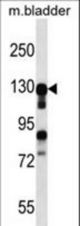 MKL2 Antibody western blot of mouse bladder tissue lysates (35 ug/lane). The MKL2 antibody detected the MKL2 protein (arrow).
