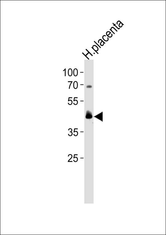 PPARD Antibody western blot of human placenta tissue lysates (35 ug/lane). The PPARD antibody detected the PPARD protein (arrow).