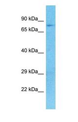 Western blot of MKLN1 Antibody with human 293T Whole Cell lysate.