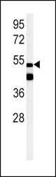 PPARG Antibody western blot of mouse heart tissue lysates (15 ug/lane). The PPARG antibody detected PPARG protein (arrow).