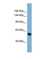 Western blot of Human HT1080. MKLN1 antibody dilution 1.0 ug/ml.