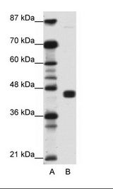 A: Marker, B: Jurkat Cell Lysate