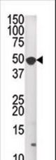 The anti-MKNK1 antibody is used in Western blot to detect MKNK1 in A2058 tissue lysate