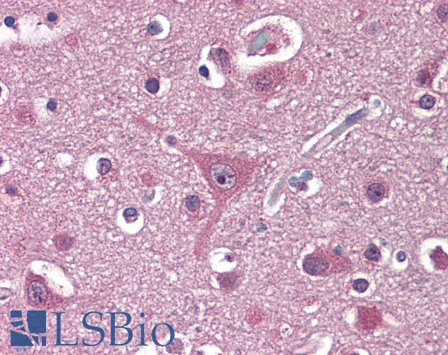 Anti-PPAT antibody IHC staining of human brain, cortex. Immunohistochemistry of formalin-fixed, paraffin-embedded tissue after heat-induced antigen retrieval.