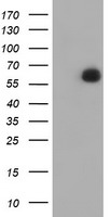 HEK293T cells were transfected with the pCMV6-ENTRY control (Left lane) or pCMV6-ENTRY PPAT (Right lane) cDNA for 48 hrs and lysed. Equivalent amounts of cell lysates (5 ug per lane) were separated by SDS-PAGE and immunoblotted with anti-PPAT.