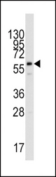 Western blot of anti-PPAT Antibody in HepG2 cell line lysates (35 ug/lane). PPAT(arrow) was detected using the purified antibody.