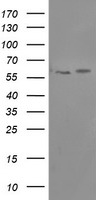 HEK293T cells were transfected with the pCMV6-ENTRY control (Left lane) or pCMV6-ENTRY PPAT (Right lane) cDNA for 48 hrs and lysed. Equivalent amounts of cell lysates (5 ug per lane) were separated by SDS-PAGE and immunoblotted with anti-PPAT.