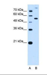 Lane A: Marker. Lane B: HepG2 cell lysate. Antibody concentration: 0.25 ug/ml. Gel concentration: 12%.