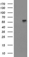 HEK293T cells were transfected with the pCMV6-ENTRY control (Left lane) or pCMV6-ENTRY PPAT (Right lane) cDNA for 48 hrs and lysed. Equivalent amounts of cell lysates (5 ug per lane) were separated by SDS-PAGE and immunoblotted with anti-PPAT.
