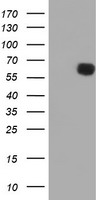 HEK293T cells were transfected with the pCMV6-ENTRY control (Left lane) or pCMV6-ENTRY PPAT (Right lane) cDNA for 48 hrs and lysed. Equivalent amounts of cell lysates (5 ug per lane) were separated by SDS-PAGE and immunoblotted with anti-PPAT.