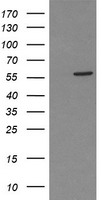 HEK293T cells were transfected with the pCMV6-ENTRY control (Left lane) or pCMV6-ENTRY PPAT (Right lane) cDNA for 48 hrs and lysed. Equivalent amounts of cell lysates (5 ug per lane) were separated by SDS-PAGE and immunoblotted with anti-PPAT.