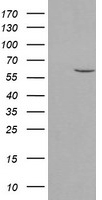 HEK293T cells were transfected with the pCMV6-ENTRY control (Left lane) or pCMV6-ENTRY PPAT (Right lane) cDNA for 48 hrs and lysed. Equivalent amounts of cell lysates (5 ug per lane) were separated by SDS-PAGE and immunoblotted with anti-PPAT.