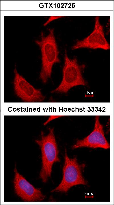 Immunofluorescence of methanol-fixed HeLa, using PPAT antibody at 1:500 dilution.