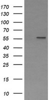 HEK293T cells were transfected with the pCMV6-ENTRY control (Left lane) or pCMV6-ENTRY PPAT (Right lane) cDNA for 48 hrs and lysed. Equivalent amounts of cell lysates (5 ug per lane) were separated by SDS-PAGE and immunoblotted with anti-PPAT.