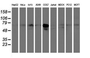 Western blot of extracts (35ug) from 9 different cell lines by using anti-PPAT monoclonal antibody.