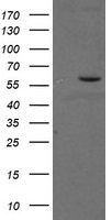 HEK293T cells were transfected with the pCMV6-ENTRY control (Left lane) or pCMV6-ENTRY PPAT (Right lane) cDNA for 48 hrs and lysed. Equivalent amounts of cell lysates (5 ug per lane) were separated by SDS-PAGE and immunoblotted with anti-PPAT.