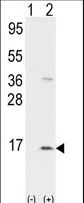 Western blot of PPBP (arrow) using rabbit polyclonal PPBP Antibody. 293 cell lysates (2 ug/lane) either nontransfected (Lane 1) or transiently transfected with the PPBP gene (Lane 2) (Origene Technologies). (8 ug/ml)