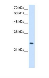 HepG2 cell lysate. Antibody concentration: 2.5 ug/ml. Gel concentration: 12%.
