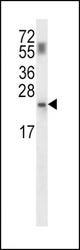 PPCDC Antibody western blot of mouse kidney tissue lysates (35 ug/lane). The PPCDC antibody detected the PPCDC protein (arrow).