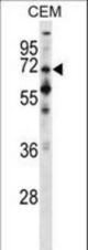 PPEF1 Antibody western blot of CEM cell line lysates (35 ug/lane). The PPEF1 antibody detected the PPEF1 protein (arrow).