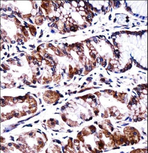PPEF2 Antibody immunohistochemistry of formalin-fixed and paraffin-embedded human stomach tissue followed by peroxidase-conjugated secondary antibody and DAB staining.