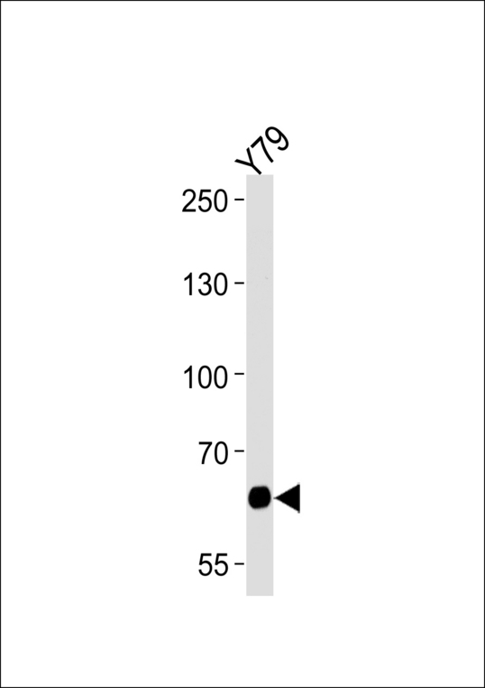 Western blot of lysate from Y79 cell line, using PPEF2 Antibody. Antibody was diluted at 1:1000 at each lane. A goat anti-rabbit IgG H&L (HRP) at 1:5000 dilution was used as the secondary antibody. Lysate at 35ug per lane.