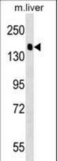 PPFIA2 Antibody western blot of mouse liver tissue lysates (35 ug/lane). The PPFIA2 antibody detected the PPFIA2 protein (arrow).