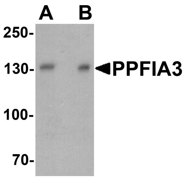 Western blot analysis of PPFIA3 in 293 cell lysate with PPFIA3 antibody at (A) 1 and (B) 2 ug/ml.