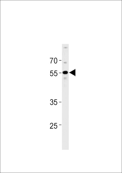 PPHLN1 Antibody western blot of A549 cell line lysates (35 ug/lane). The PPHLN1 antibody detected the PPHLN1 protein (arrow).