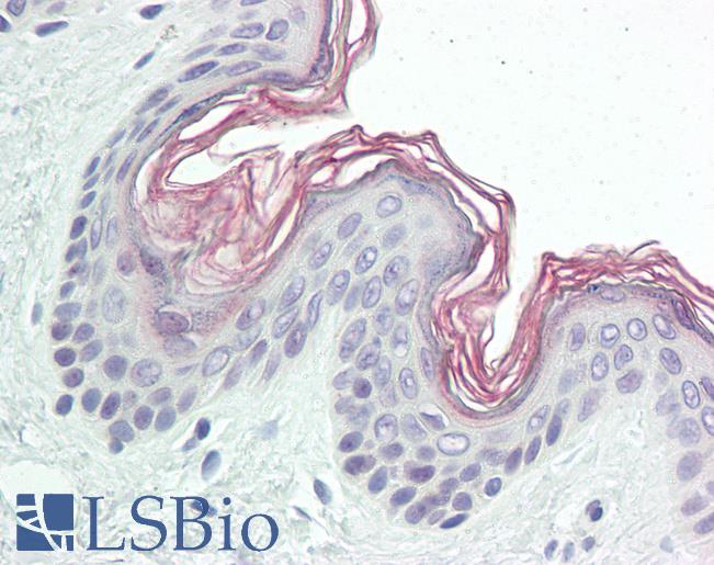 Anti-PPHLN1 antibody IHC of human skin. Immunohistochemistry of formalin-fixed, paraffin-embedded tissue after heat-induced antigen retrieval. Antibody LS-B8424 dilution 10 ug/ml.