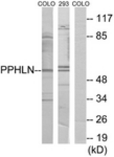 Western blot of extracts from COLO/293 cells, using PPHLN Antibody. The lane on the right is treated with the synthesized peptide.