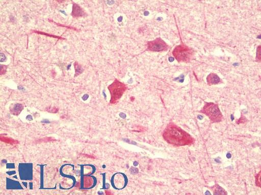 Anti-PPHLN1 antibody IHC staining of human brain, cortex. Immunohistochemistry of formalin-fixed, paraffin-embedded tissue after heat-induced antigen retrieval. Antibody LS-B9596 concentration 10 ug/ml.