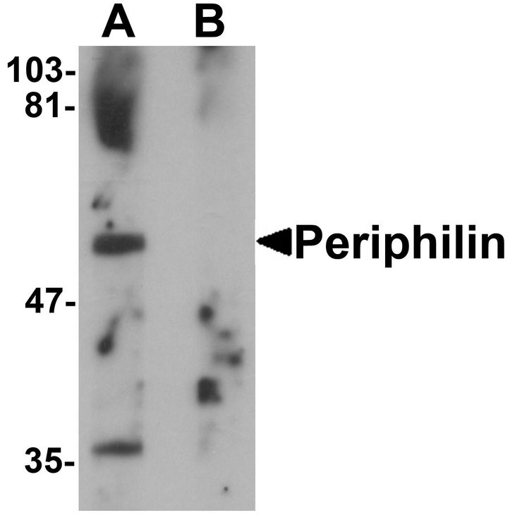 Western blot analysis of Periphilin in mouse colon tissue lysate with Periphilin antibody at 1 ug/ml in (A) the absence and (B) the presence of blocking peptide.