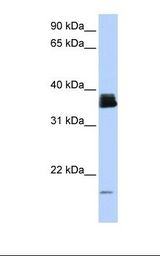 Fetal brain lysate. Antibody concentration: 1.0 ug/ml. Gel concentration: 12%.