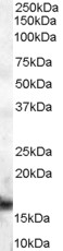 Antibody (2 ug/ml) staining of human lymph node lysate (35 ug protein in RIPA buffer). Primary incubation was 1 hour. Detected by chemiluminescence.