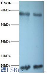 Western blot of Peptidyl-prolyl cis-trans isomerase A antibody at 2 ug/ml. Lane 1:293T whole cell lysate. Lane 2: EC109 whole cell lysate. Secondary: Goat polyclonal to Rabbit IgG at 1:15000 dilution. Predicted band size: 18 kDa. Observed band size: 18 kDa Additional bands at: 80 kDa. We are unsure as to the identity of this extra band.