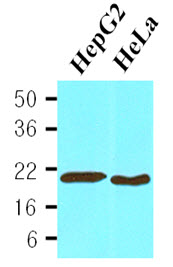 Cell lysates of HepG2(30 ug) and HeLa(30 ug) were resolved by SDS-PAGE, transferred to NC membrane and probed with anti-human Cyclophilin B (1:1000). Proteins were visualized using a goat anti-mouse secondary antibody conjugated to HRP and an ECL detection.