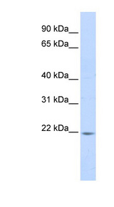 PPIB / Cyclophilin B antibody LS-C110939 Western blot of Fetal Liver lysate.