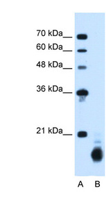 PPIB / Cyclophilin B antibody LS-C40473 Western blot of HepG2 cell lysate.