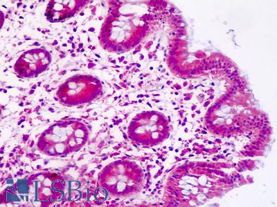 Human, Colon: Formalin-Fixed Paraffin-Embedded (FFPE)
