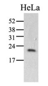 Western Blot: The HeLa (40 ug) were resolved by SDS-PAGE, transferred to PVDF membrane and probed with anti-human PPIC antibody (1:1000). Proteins were visualized using a goat anti-mouse secondary antibody conjugated to HRP and an ECL detection system.