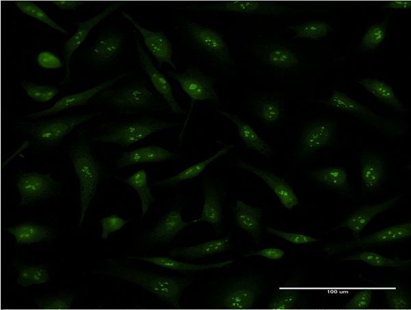 Immunofluorescence of monoclonal antibody to PPID on HeLa cell . [antibody concentration 10 ug/ml]