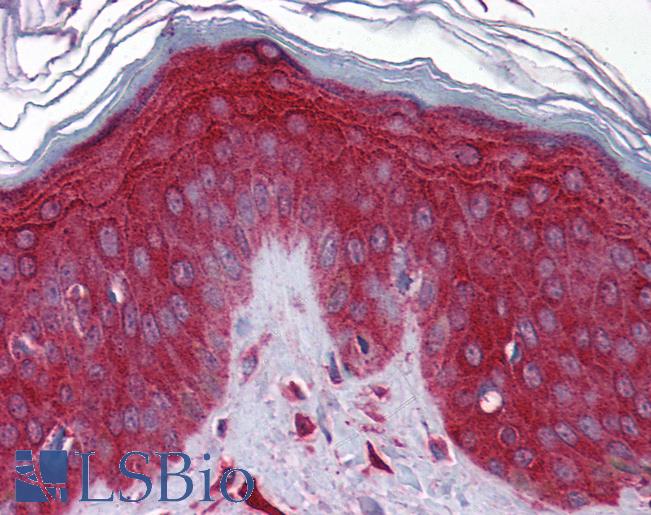 Anti-PPID / Cyclophilin 40 antibody IHC of human skin. Immunohistochemistry of formalin-fixed, paraffin-embedded tissue after heat-induced antigen retrieval. Antibody LS-B5870 concentration 5 ug/ml.