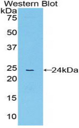 Western blot of recombinant PPID / Cyclophilin D.